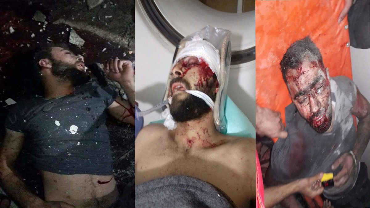 11 إعلامياً سورياً قضوا خلال الشهر الماضي ورابطة الصحفيين تستنكر 