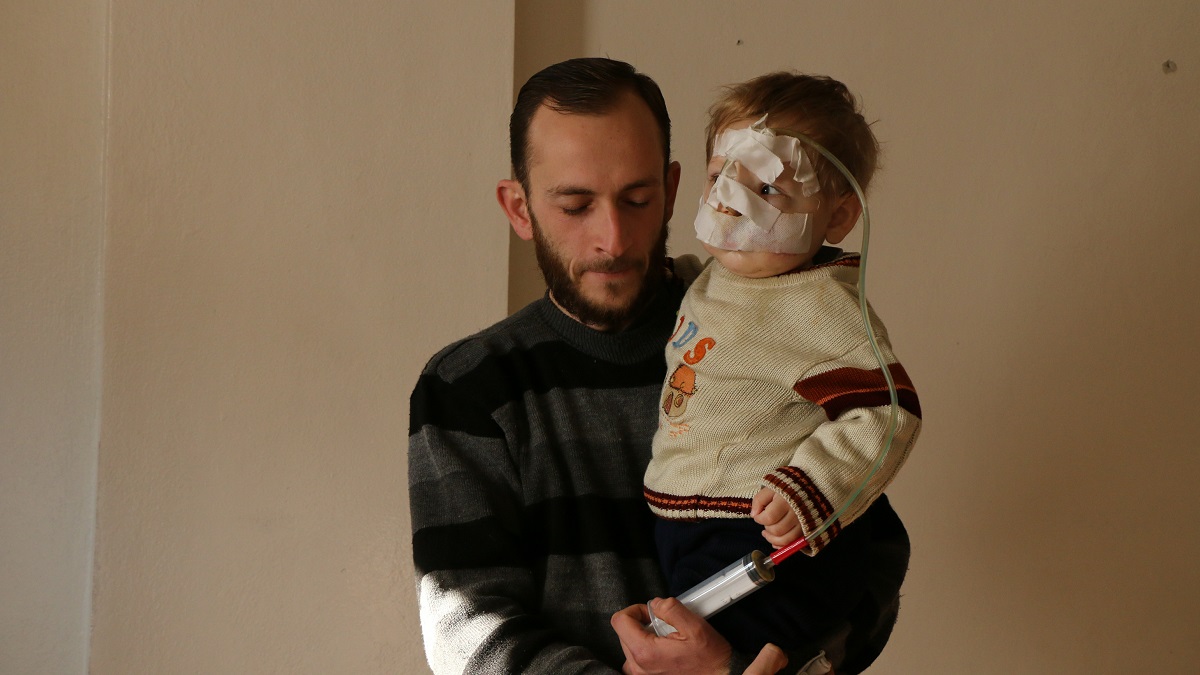 بالصور: طفل سوري محاصر بالغوطة يفقد والدته وتفقده الإصابة القدرة على الكلام
