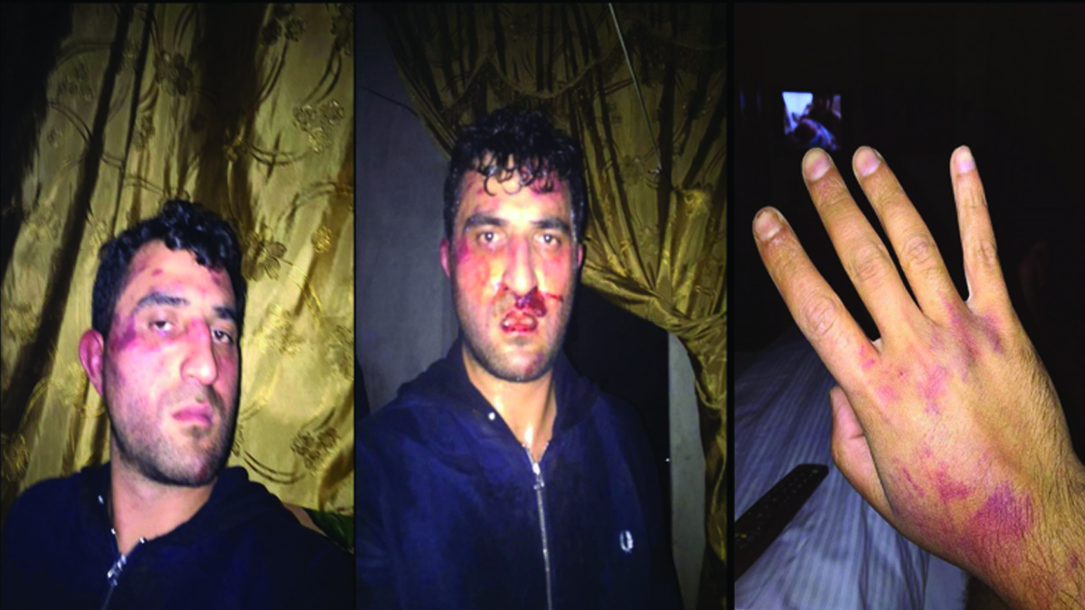 بالصور: "الجندرمة التركية" تعتدي على رئيس تحرير "أنا برس"