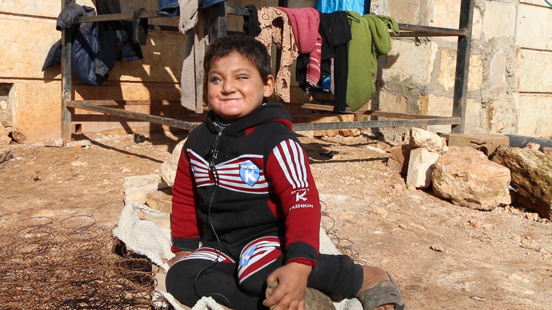 مرض مجهول يفتك بجسد طفل سوري